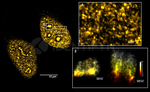 PARP1 Antibody in Immunocytochemistry (ICC/IF)