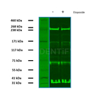 BRCA1 Antibody in Western Blot (WB)