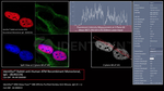 ATM Antibody in Immunocytochemistry (ICC/IF)