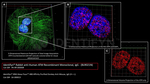 ATM Antibody in Immunocytochemistry (ICC/IF)