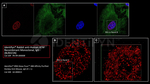 ATM Antibody in Immunocytochemistry (ICC/IF)