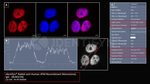 ATM Recombinant Rabbit Monoclonal Antibody (BLR021N), Identifyn™