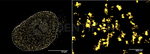 ATM Antibody in Immunocytochemistry (ICC/IF)