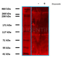 ATM Antibody in Western Blot (WB)