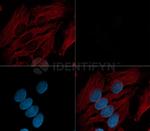 RAD51 SRM Antibody in Immunocytochemistry (ICC/IF)