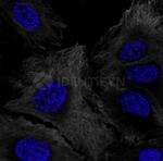 gamma-H2AX SRM Antibody in Immunocytochemistry (ICC/IF)