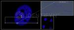 gamma-H2AX SRM Antibody in Immunocytochemistry (ICC/IF)