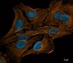 gamma-H2AX SRM Antibody in Immunocytochemistry (ICC/IF)