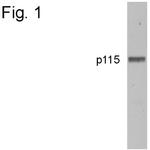 VDP Antibody in Western Blot (WB)