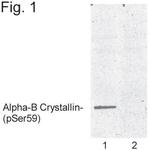 Phospho-CRYAB (Ser59) Polyclonal Antibody