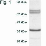 Biliverdin Reductase Antibody in Western Blot (WB)