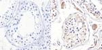 ADORA2A Antibody in Immunohistochemistry (Paraffin) (IHC (P))