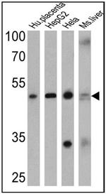 ADORA2A Antibody in Western Blot (WB)