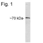 CETP Polyclonal Antibody