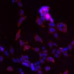 LMAN1 Antibody in Immunocytochemistry (ICC/IF)