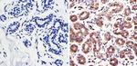 RAC1 Antibody in Immunohistochemistry (IHC)