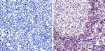 RAC1 Antibody in Immunohistochemistry (IHC)