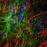 GFAP Polyclonal Antibody