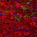 NSE Polyclonal Antibody