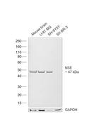 NSE Antibody