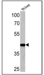 Adiponectin Receptor 2 Antibody in Western Blot (WB)