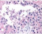 ATM Antibody in Immunohistochemistry (IHC)