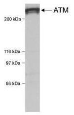 ATM Antibody in Western Blot (WB)