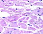 HIF-2 alpha Antibody in Immunohistochemistry (Paraffin) (IHC (P))