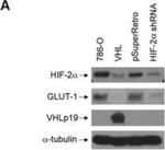 HIF-2 alpha Antibody in Western Blot (WB)