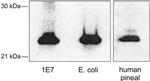 AANAT Antibody in Western Blot (WB)