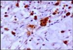 PHD3 Antibody in Immunohistochemistry (Paraffin) (IHC (P))