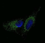 Aromatase Polyclonal Antibody