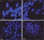 53BP1 Antibody in Immunocytochemistry (ICC/IF)