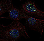 53BP1 Antibody in Immunocytochemistry (ICC/IF)