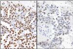 53BP1 Antibody in Immunohistochemistry (Paraffin) (IHC (P))