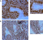 53BP1 Antibody in Immunohistochemistry (Paraffin) (IHC (P))