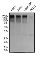 53BP1 Antibody in Western Blot (WB)