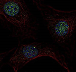 53BP1 Antibody in Immunocytochemistry (ICC/IF)