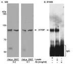 ATRIP Antibody in Western Blot (WB)