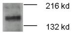 ATP7B Antibody in Western Blot (WB)
