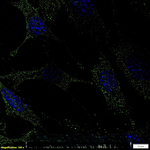 CTR1 Polyclonal Antibody