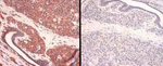 CTR1 Antibody in Immunohistochemistry (Paraffin) (IHC (P))