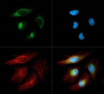 DERL1 Polyclonal Antibody