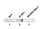DLX4 Antibody in Immunoprecipitation (IP)