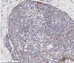 VEGF Receptor 1/2 Antibody in Immunohistochemistry (Paraffin) (IHC (P))