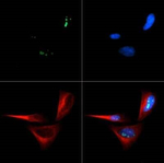 p14ARF Polyclonal Antibody