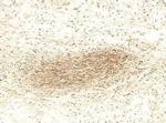MMP2 Antibody in Immunohistochemistry (IHC)