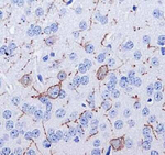 TACR1 Antibody in Immunohistochemistry (IHC)