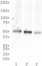 TACR1 Antibody in Western Blot (WB)