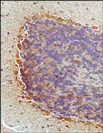 NKB Polyclonal Antibody